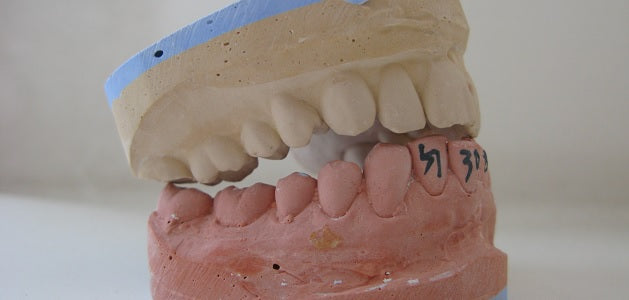 Zahnfleischentzündung und Mundschleimentzündung